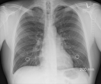 Kim jest pulmonolog i kiedy warto skorzystać z jego pomocy?